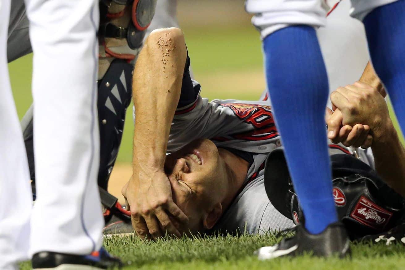 Top 10 Baseball's Worst Injuries Ever